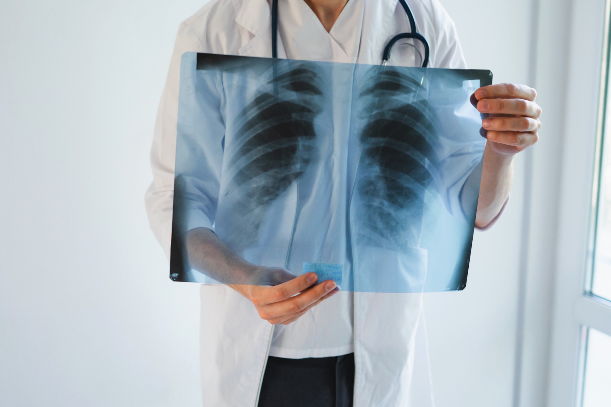 work-related respiratory disease background