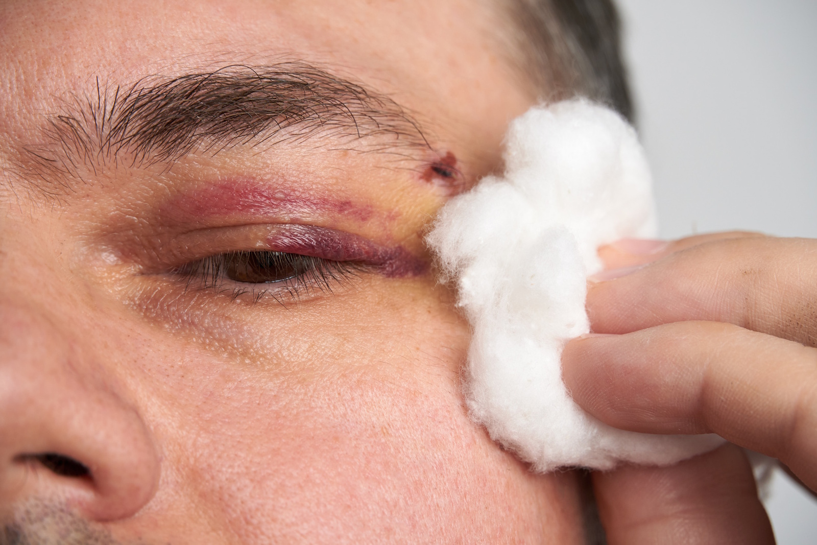 vision loss at work background